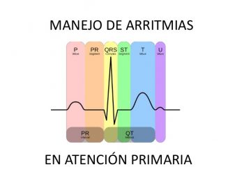 Serie Infografías: Arritmias en ECG