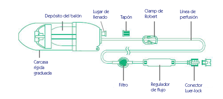 Abordaje del Infusor Elastomérico (contiene video)