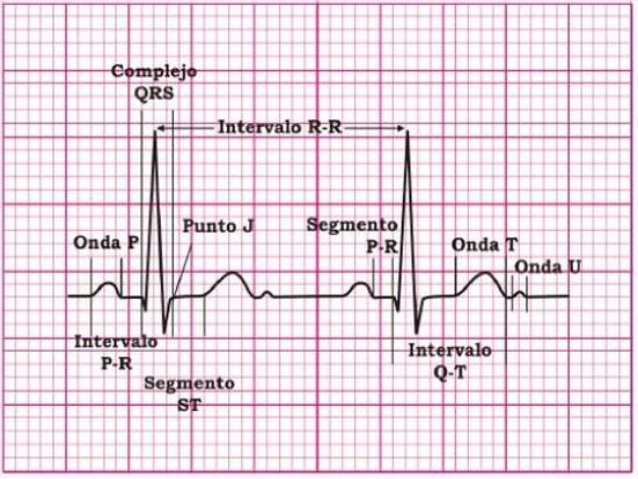 Píldoras Formativas: Lectura Sistemática del ECG