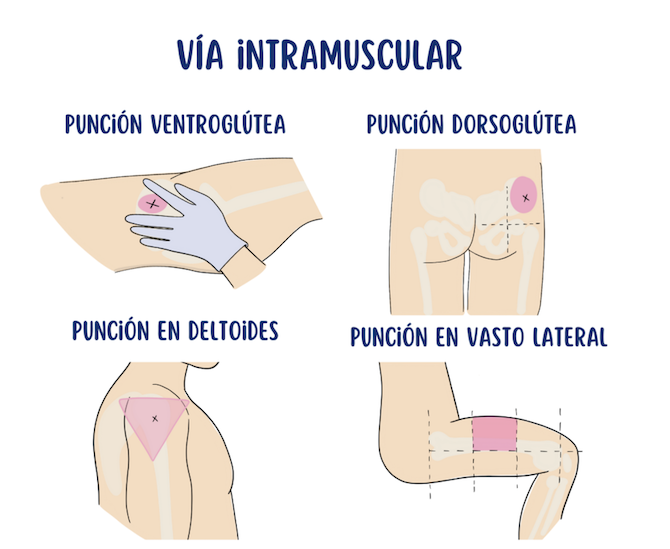 Evidencias: Usos de la Vía Intramuscular