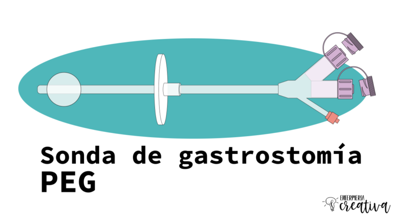 Abordaje de la sonda PEG